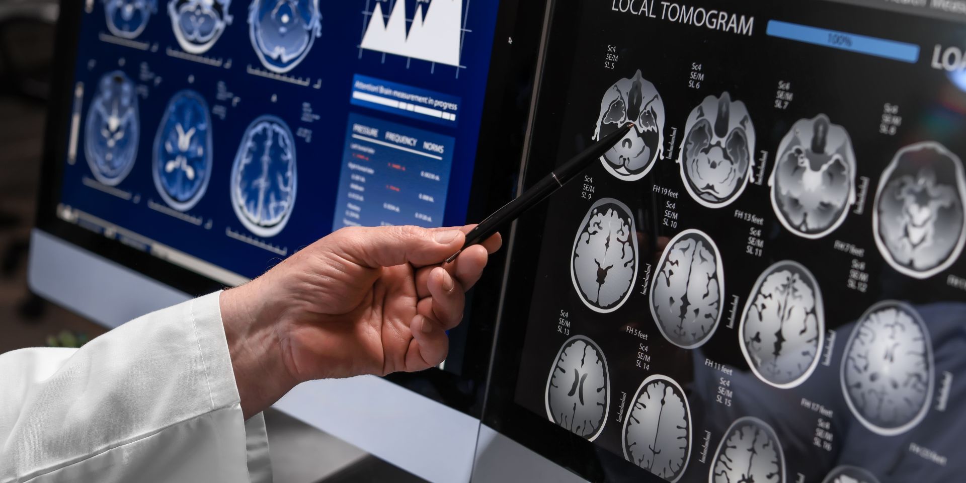Imagen médica de resonancia utilizada en la página original