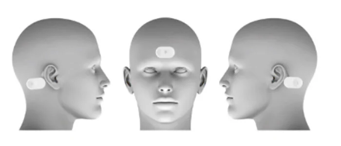 Esquema de la colocación del dispositivo VISOR EEG